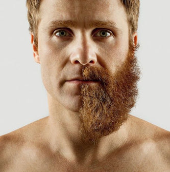 10 Celebrities Who Look Better With Beards